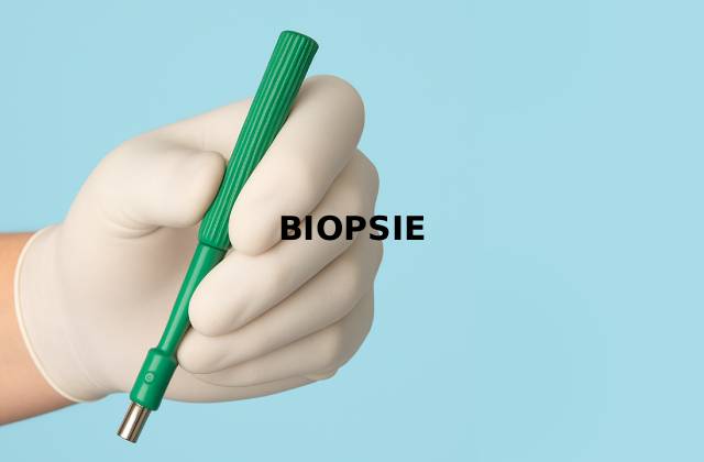 Biopsie