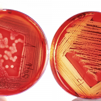 candida-gardnerella-seletivagar
