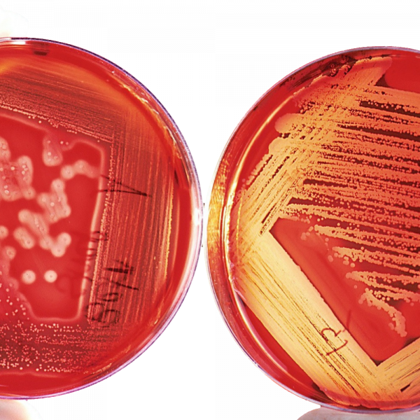 candida-gardnerella-seletivagar